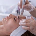 RF-Microneedling
