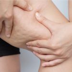 Thigh-cellulite